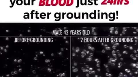 Look What Happens To Your Blood Just 24 Hours After Grounding!