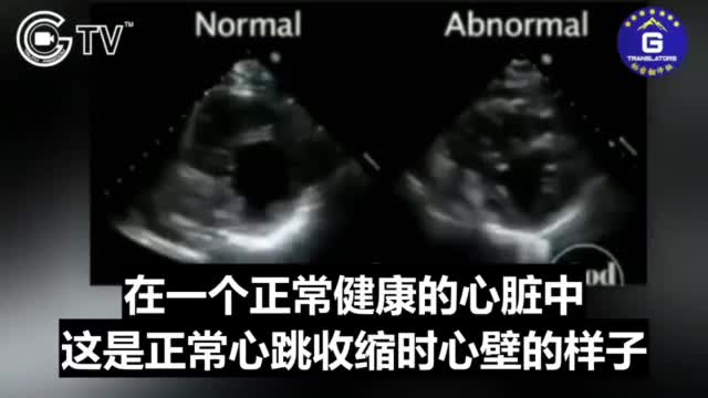 打馬賽克的吹哨者