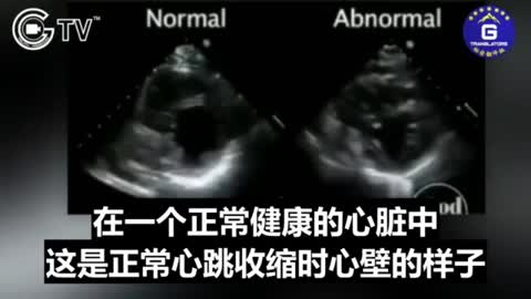 打馬賽克的吹哨者