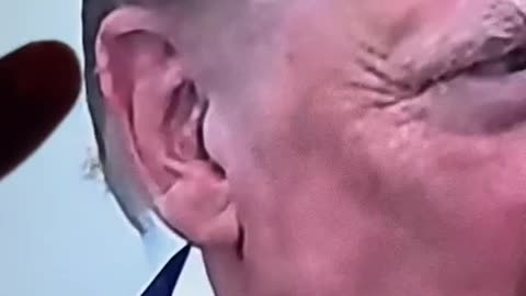 Trump's ear scar