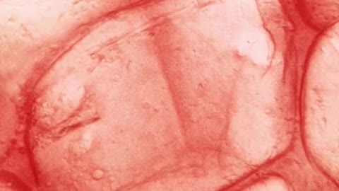 meat microscope