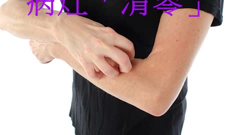 乾癬可控 病灶「清零」