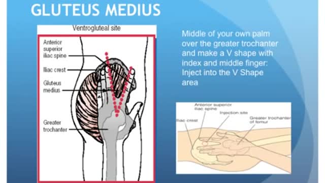 Injection site for intra muscular