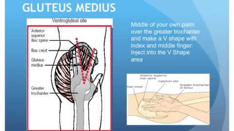 Injection site for intra muscular