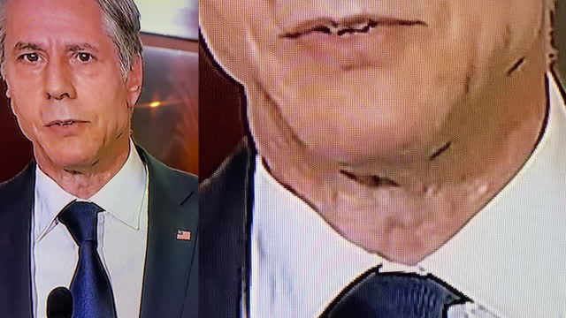 Tony Blinken's alien neck face is more expressive than his actual face - You can't unsee this