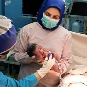 Cesarean section in shomal hospital