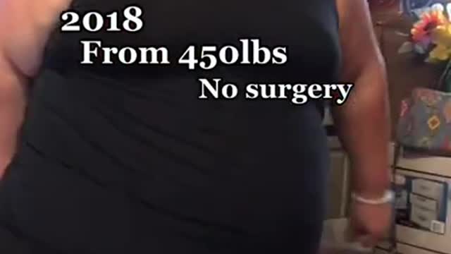 My 280lbs Weight Loss Transformation 👌🏼 Keto Diet Success Story