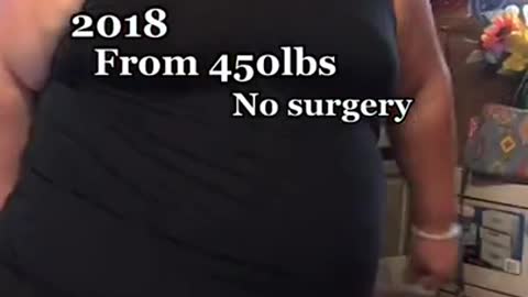 My 280lbs Weight Loss Transformation 👌🏼 Keto Diet Success Story