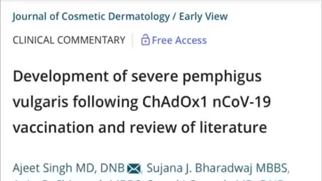 This Covid-19 Vaccine Injury Looks Like Something Out Of A Horror Movie