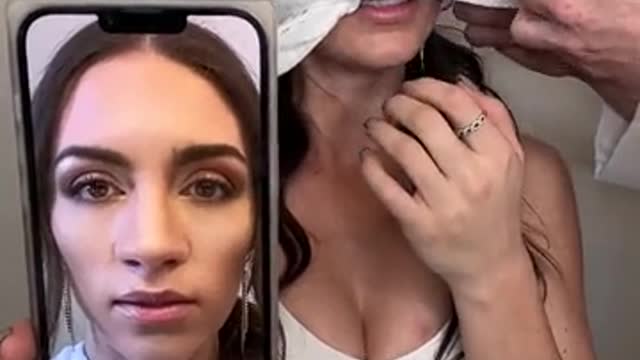 CRAZIEST nose job transformation I've ever seen!!