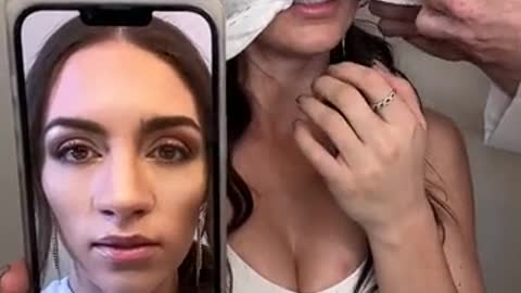 CRAZIEST nose job transformation I've ever seen!!