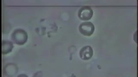 Anthrax molecule transformation