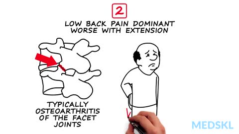 Orthopedics – Low Back Pain