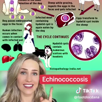 TikTok MDs are now warning Haitians about the diseases they can get from eating dogs / cats