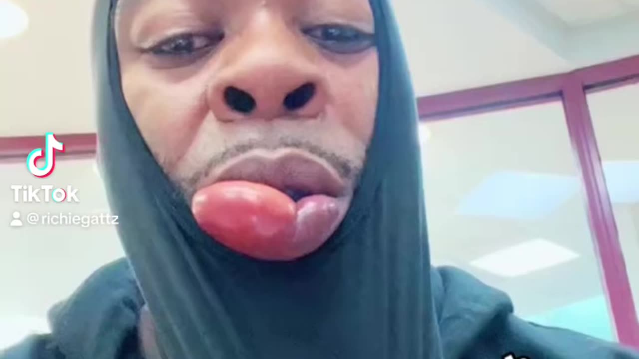 Bro opps is the beess