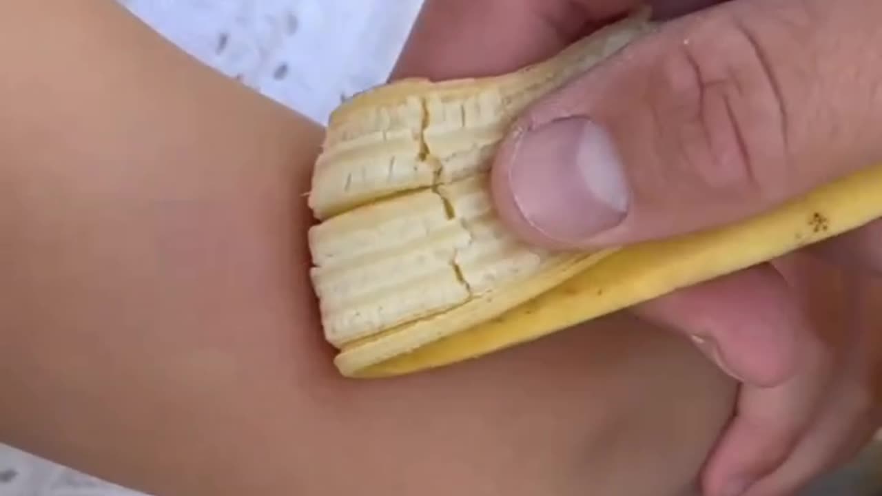 Did you know that you can use a banana peel to relieve the itch of a mosquito bite?