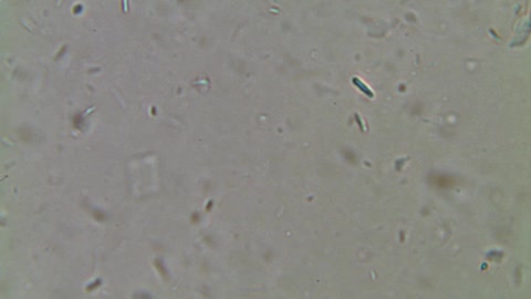 Biontech unter dem Phasenkontrastmikroskop