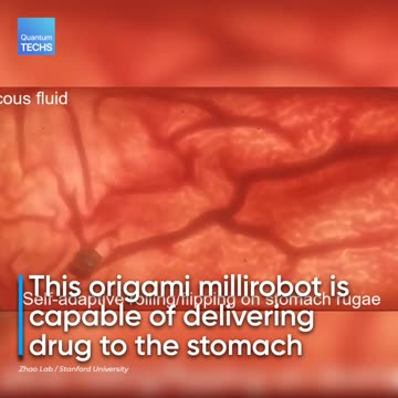 Stanford engineers develop tiny robots to bring health care