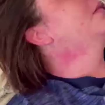 Bad reaction to the JAB