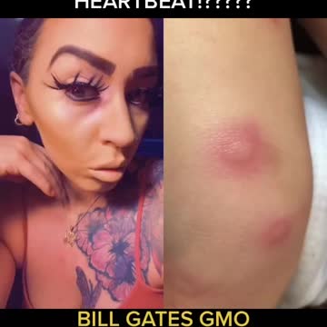 Exposing Bill Gates GMO mosquitoes