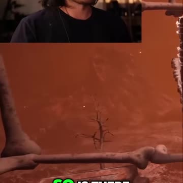 Navigating the Bone Zone: A Hilarious Adventure