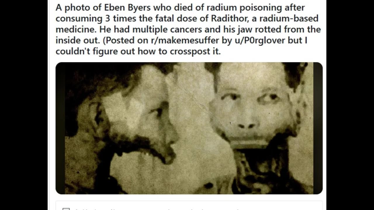 The Man Who Drank So Much Radiation He Became Radioactive & Had to be Buried in a Lead Lined Coffin