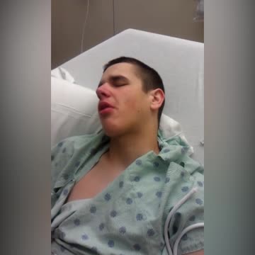 This Post-Surgery Teen Thinks His Shirt Is A Burger, And Tries To Eat It