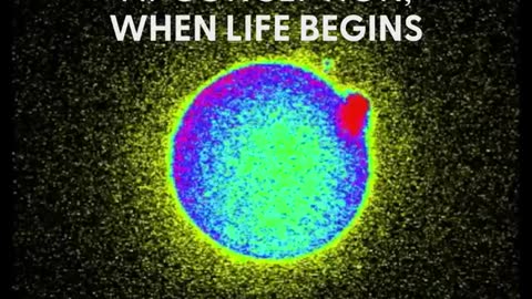 The Moment Life Begins!