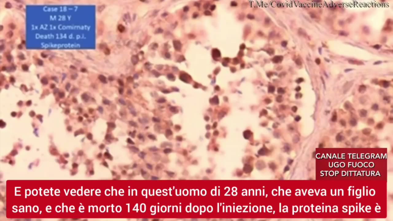 HERE'S WHAT COULD HAVE LED TO THE KILLING OF THE PROF. BURKHARDT