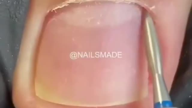 most satisfying pedicure transformation #shorts #pedicure #nails