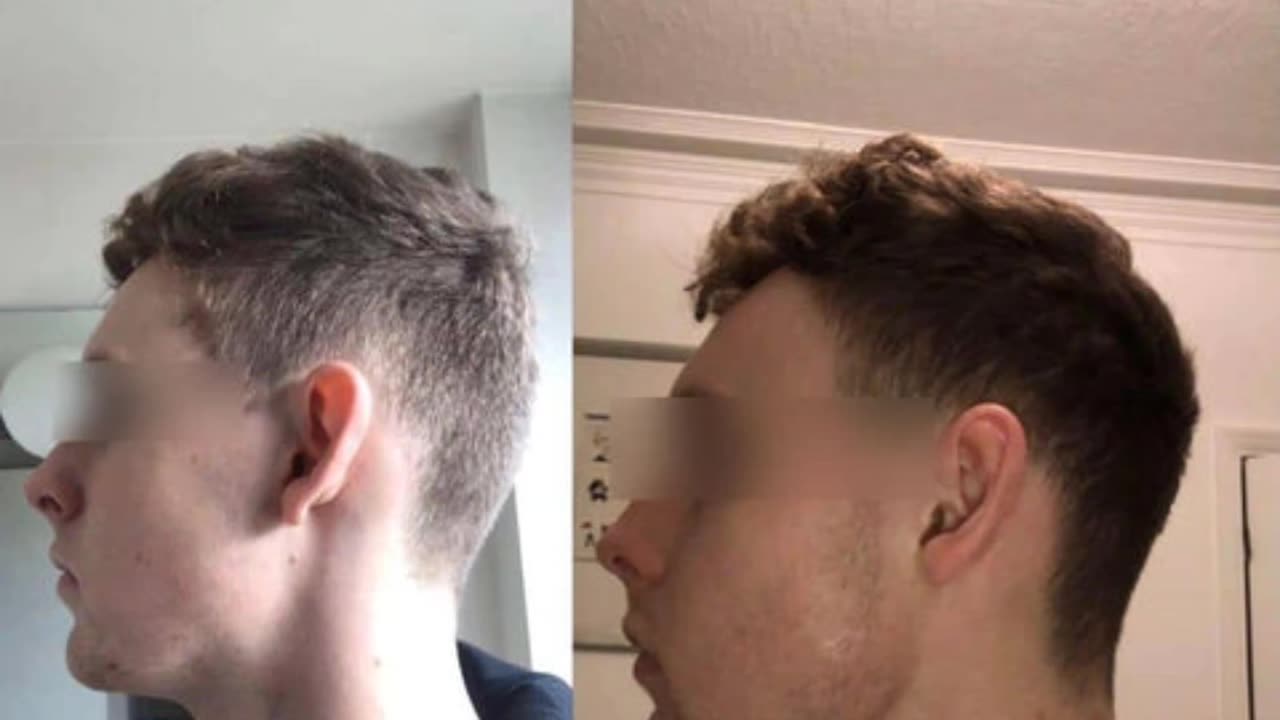INSANE MEWING TRANSFORMATION !