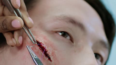 PAINFUL SCAR