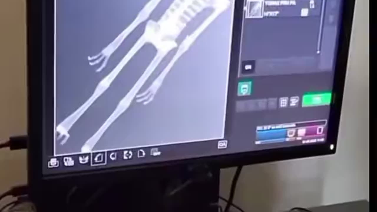 Mexican Government Releases Video of Mummified “Alien” Internal Bone Structure