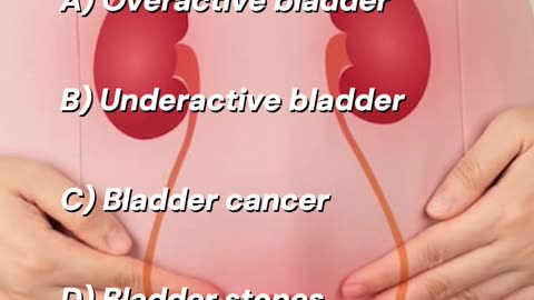 The Bladder - Questions & Answers.