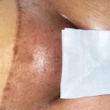 Bikini Waxing with Sexy Smooth Tickled Pink Wax! By Silk'd By Suga Esthetics 🌺✨