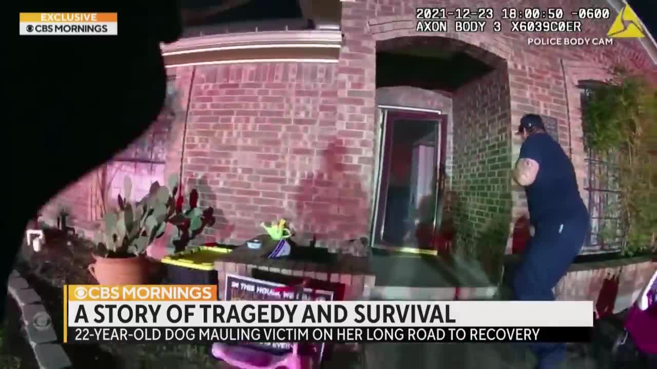"It's time to show who I am now": Dog sitter recovering after losing face in horrific dog attack