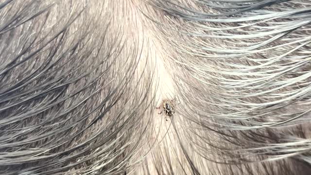 Removing a Tick From a Client's Head