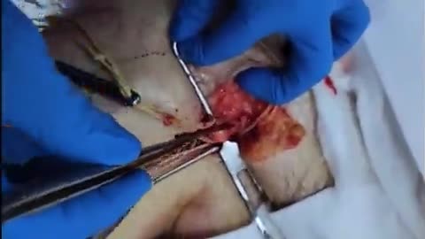 Yuck (clots)