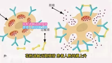 花粉過敏近期頻發 患者人數持續上升