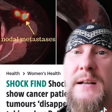 Medical Cures For Cancer