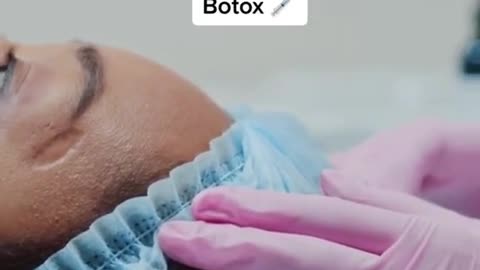 Youngsters are illegally injecting themselves withBotox
