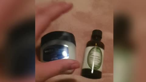 Burn Nits Lice To Death With Oregano Oil Adult Treatment Only