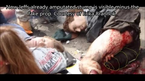 Boston Bomb Fake Victims Brannocks