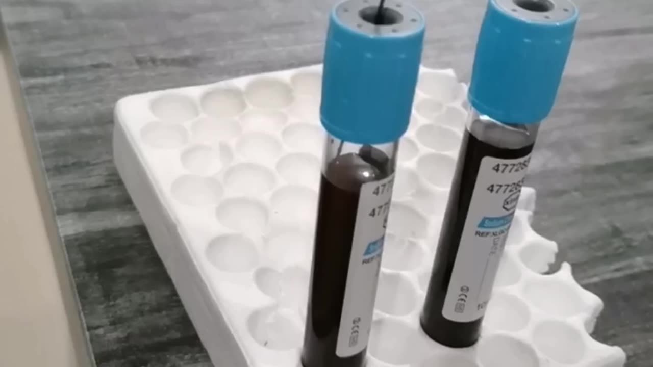 Prp for hairs fall
