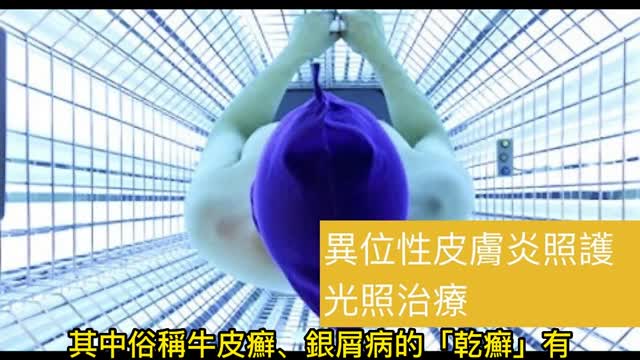 照光治療 有效治乾癬