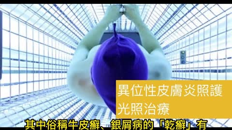 照光治療 有效治乾癬