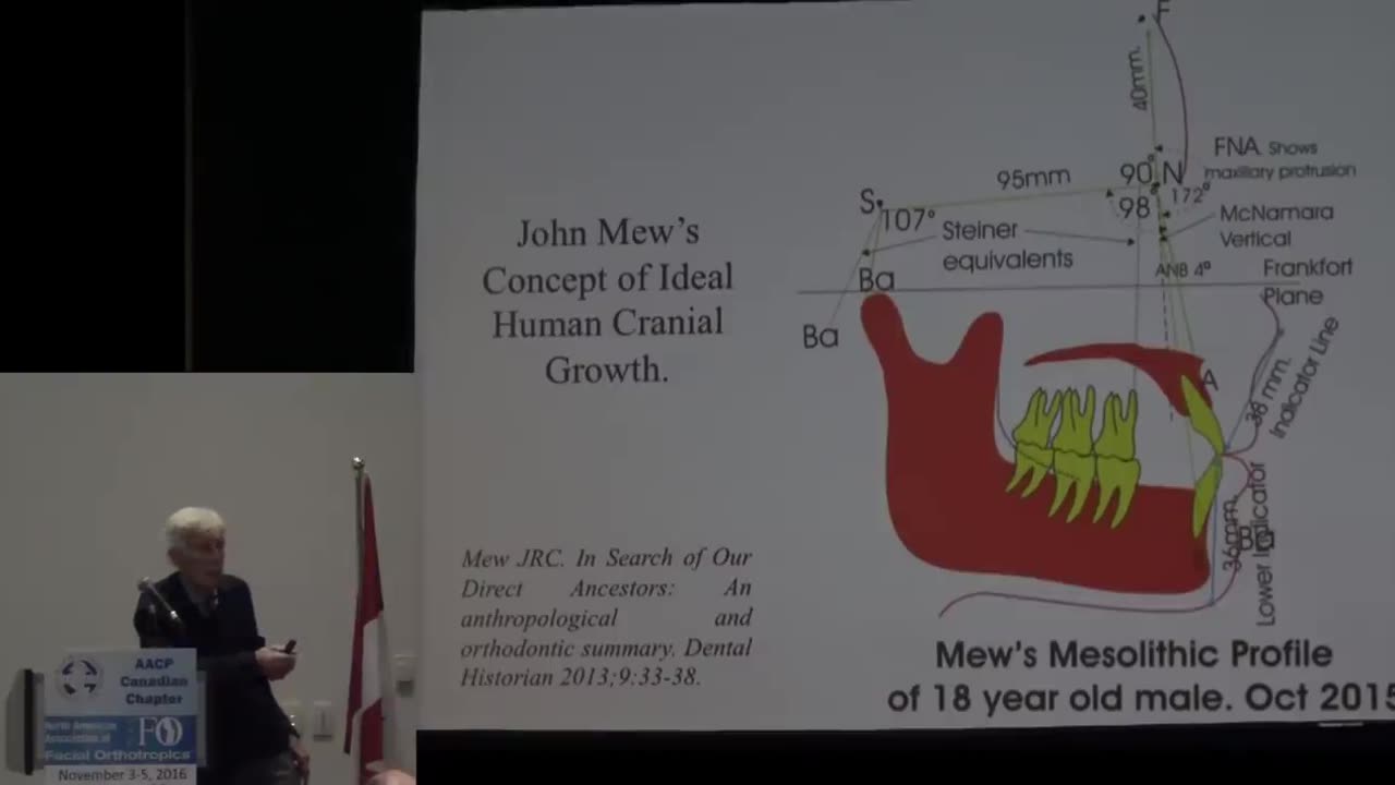 How Best To Achieve Forward Facial Growth By Prof John Mew. Vancouver | November 2016