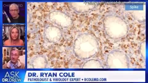 Spike Proteins from Jabs Activating Cancers in Remission - Drs. Cole, Drew, Kelly