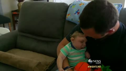 'Miracle Baby' Born Without Most of His Brain Defying Odds | ABC News