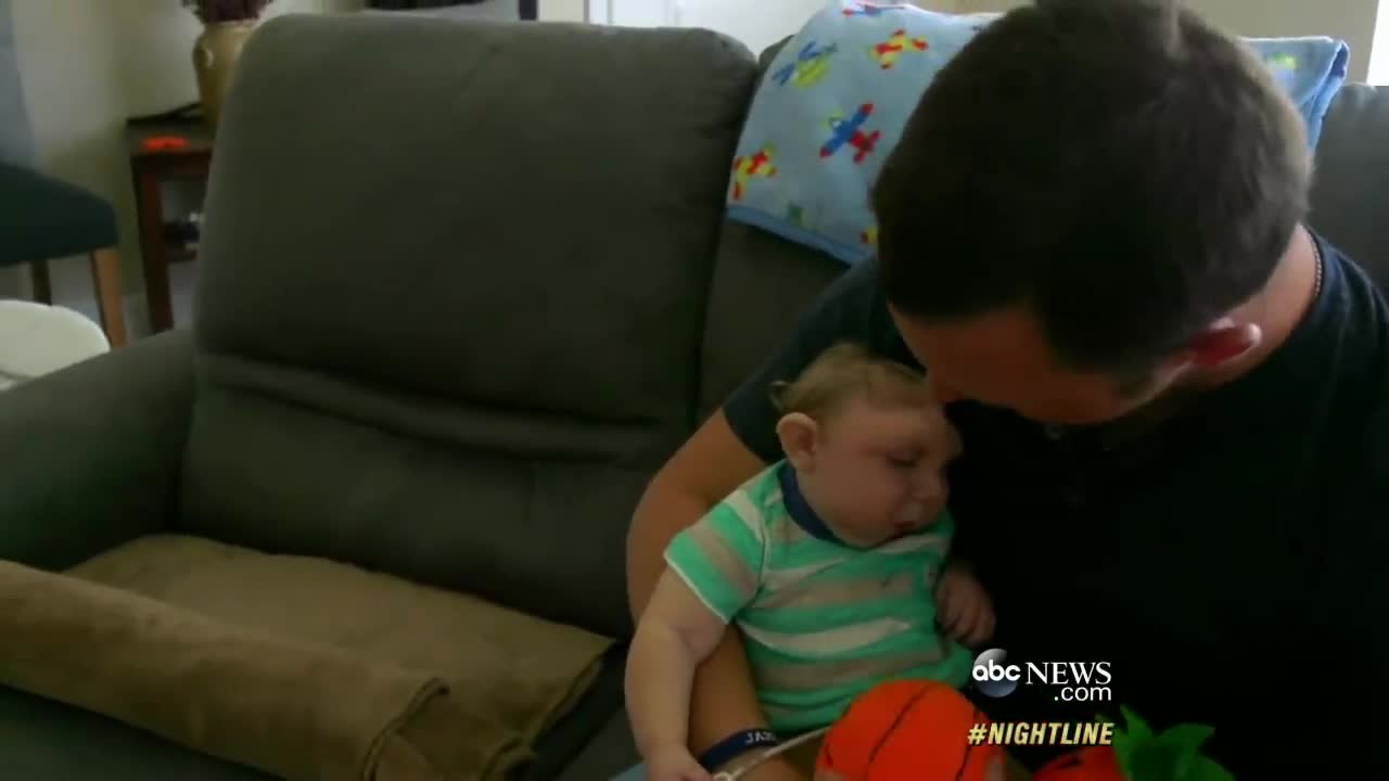 'Miracle Baby' Born Without Most of His Brain Defying Odds | ABC News